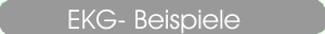 EKG-Beispiele der Schrittmachertypen 